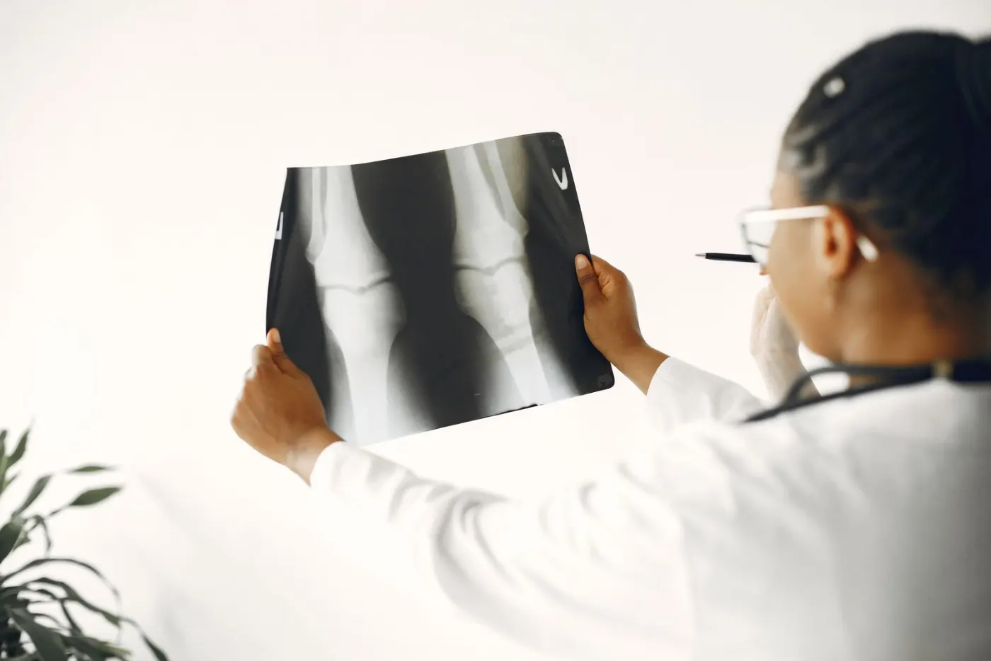 A doctor holding up a knee X-ray