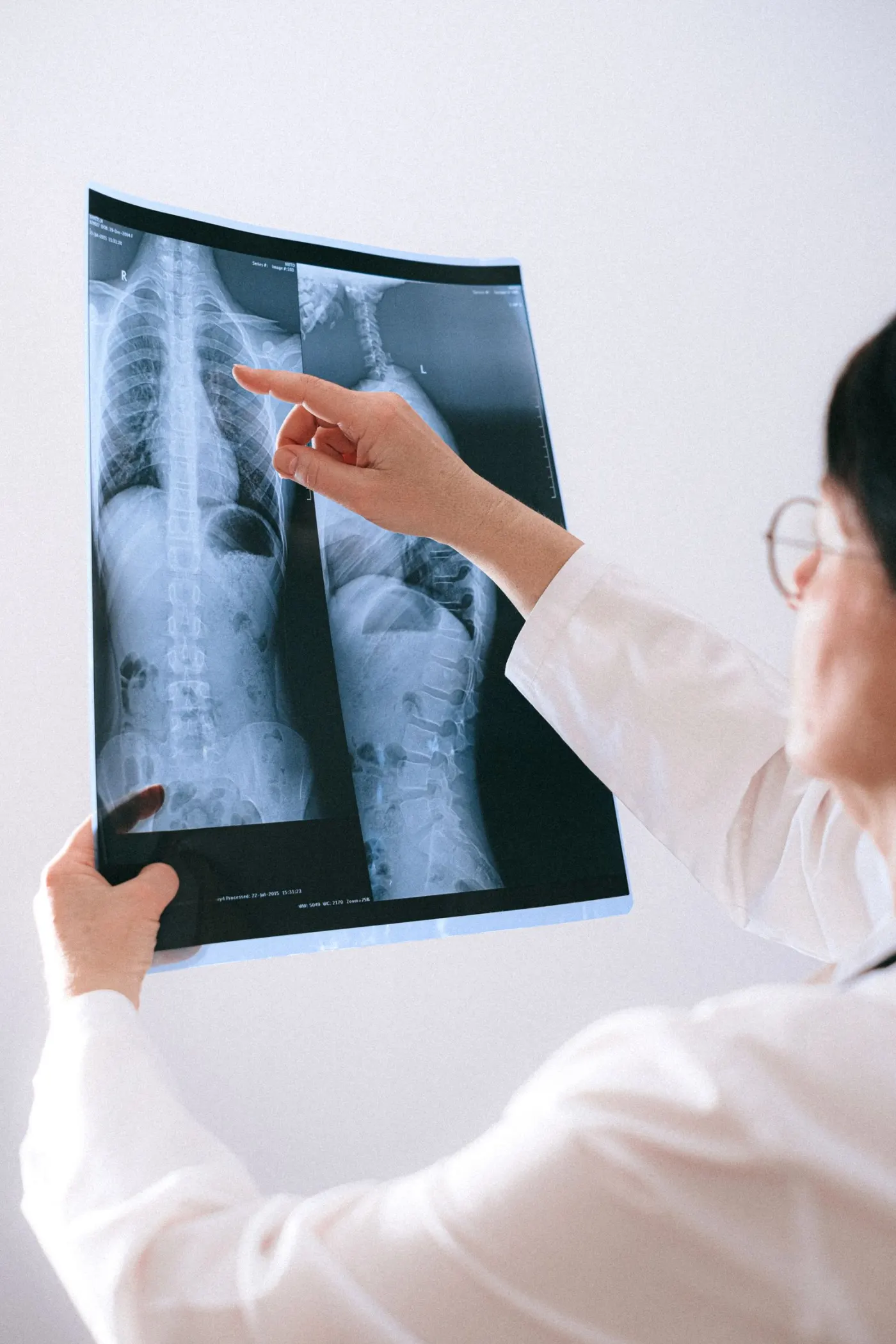A doctor pointing at a spine X-ray