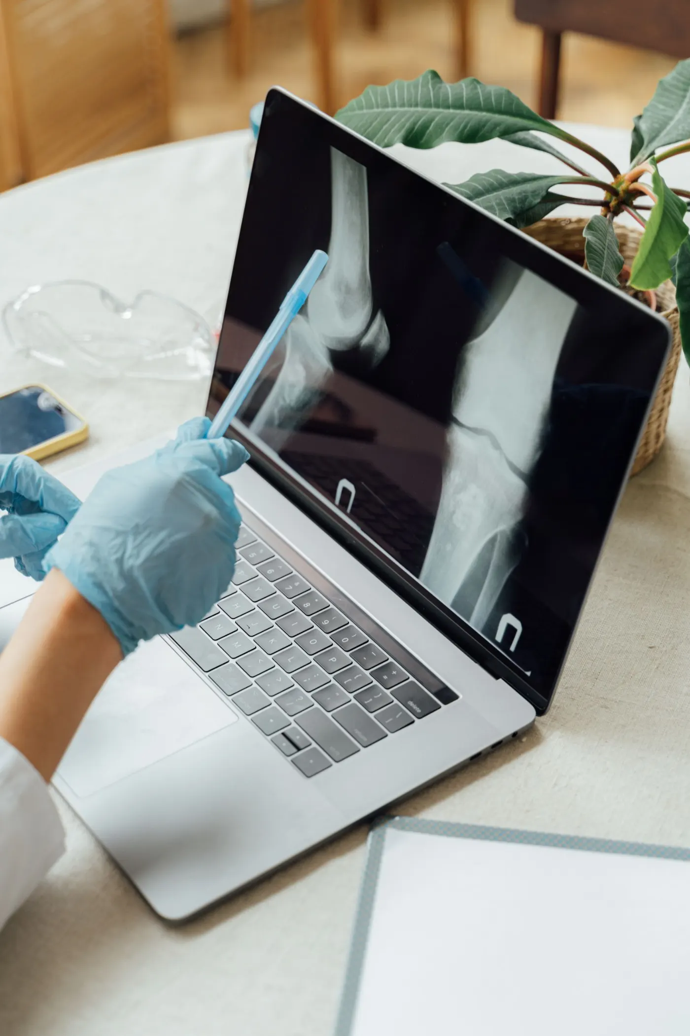 A doctor in gloves reviewing a knee X-ray on a laptop
